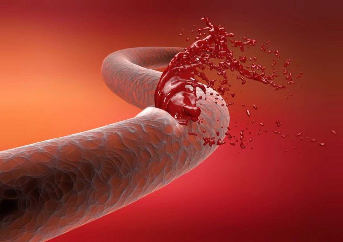A hydrogel that can stop bleeding from an artery