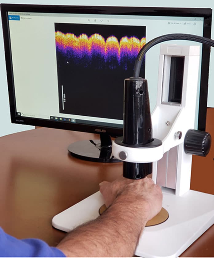 The virtual biopsy prototype device can distinguish between healthy skin and different types of skin lesions and carcinomas./ Image: Rutgers University