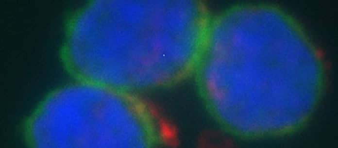 B lymphocytes (blue and green) and gold nanoparticles (red) measured with dark field hyperspectral imaging coupled with fluorescent detection. © UNIGE