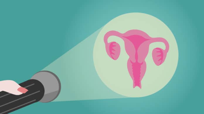Why some women are more prone to develop cervical cancer?
