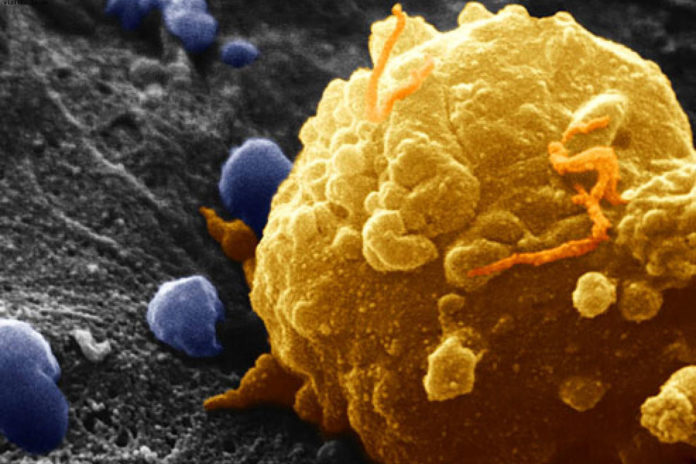 New laser can detect and kill cancer cells right in the bloodstream
