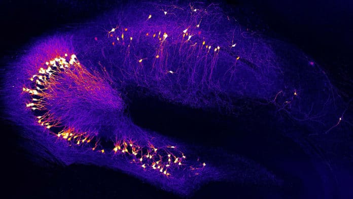 Neurons in the hippocampus, a brain region for learning and memory, that is impaired already at early stages of Alzheimer´s disease. Image: Y. Zhang und A. Konnerth / TUM