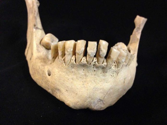 Ancient human remains tested in the study from the collections of the Dorset County Museum.
