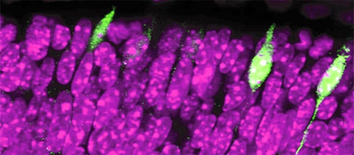Photoreceptors cells responsible for colour vision. By sequencing one cell at a time, the researchers identified a gene (Rbp4) present in a small number of cells (in green). In purple, photoreceptors in which the Rbp4 gene is not activated.