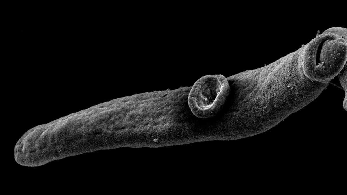 A juvenile blood fluke. Schistosomiasis infection can lead to liver cirrhosis, among others. Image: Clarissa Prazeres da Costa / TUM