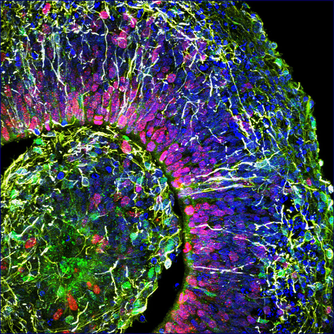 A cross-section of a brain organoid, showing the initial formation of a cortical plate. Each color marks a different type of brain cell. Credit: Muotri Lab/UCTV