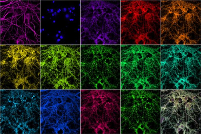 Researchers at MIT and the Broad Institute of Harvard and MIT have devised a new way to rapidly image synaptic proteins at high resolution. Using fluorescent nucleic acid probes, they can label and image as many as 12 different proteins in neuronal samples containing thousands of synapses.