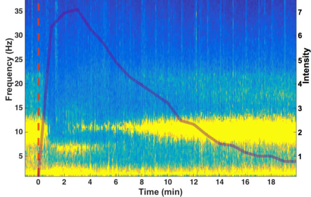 Brain activity measured during DMT experience shows a visible difference in electrical activity readout compared to placebo. The red line shows the volunteer's subjective rating of the intensity of experience (Credit: Chris Timmermann)