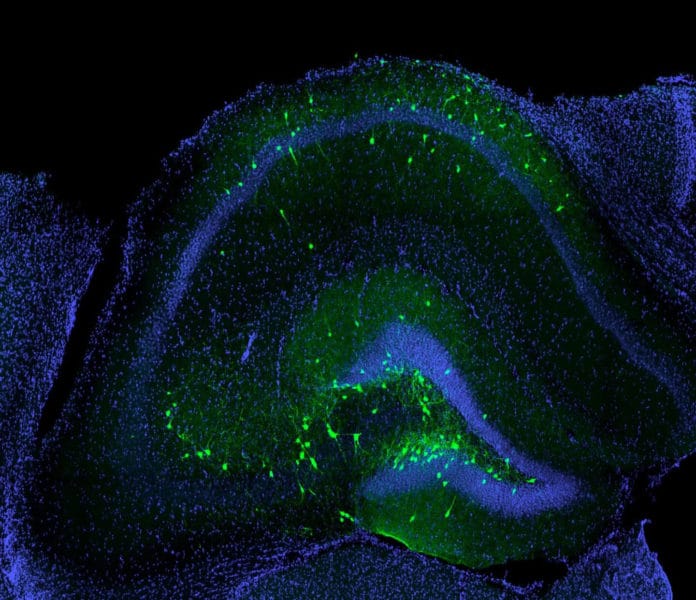 Transplanted inhibitory neurons (green) successfully incorporated into the hippocampus of a mouse with traumatic brain injury.