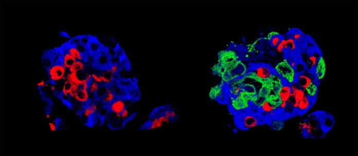 Left: a standard Langerhans islet, and right: a “super islet”. Insulin cells (beta cells) are in blue and glucagon cells (alpha cells) in red; the «super-islet» has, in addition, amniotic epithelial cells, in green. © UNIGE