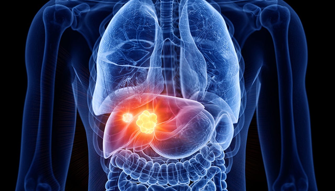 Scientists found four potential liver cancerkilling