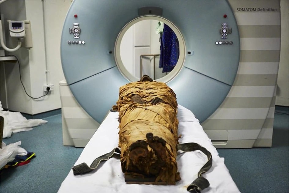 The mummified body of Nesyamun laid on the couch to be CT scanned at Leeds General Infirmary. © Leeds Teaching Hospitals/Leeds Museums and Galleries.
