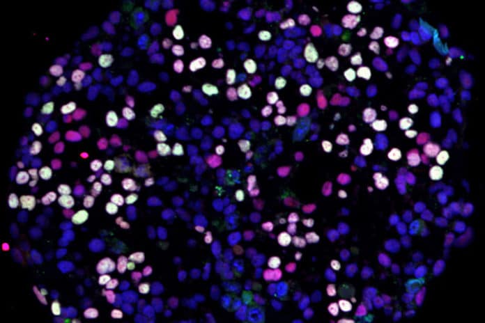 Differentiating human pluripotent stem cells (blue) turning into human germ cells (pink and white). Credit: Broad Stem Cell Research Center