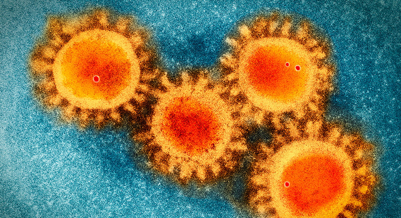 Electron microscopy photo of the COVID-19 coronavirus