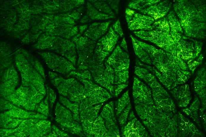 Using a two-photon fluorescence microscope with an extra-large field of view, UC Berkeley researchers imaged neurons (green) in a large chunk of the cortex of the brain of a living mouse. The area shows neurites in a volume of 4.2 mm × 4.2 mm x 100 microns. The dark branches are blood vessels. (UC Berkeley image by Na Ji)