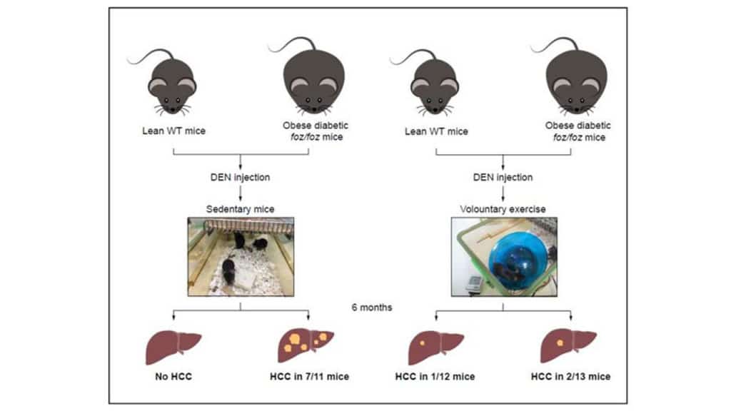 Scheme illustrating how exercise attenuates liver cancer development in obese and diabetic mice compared with sedentary mice