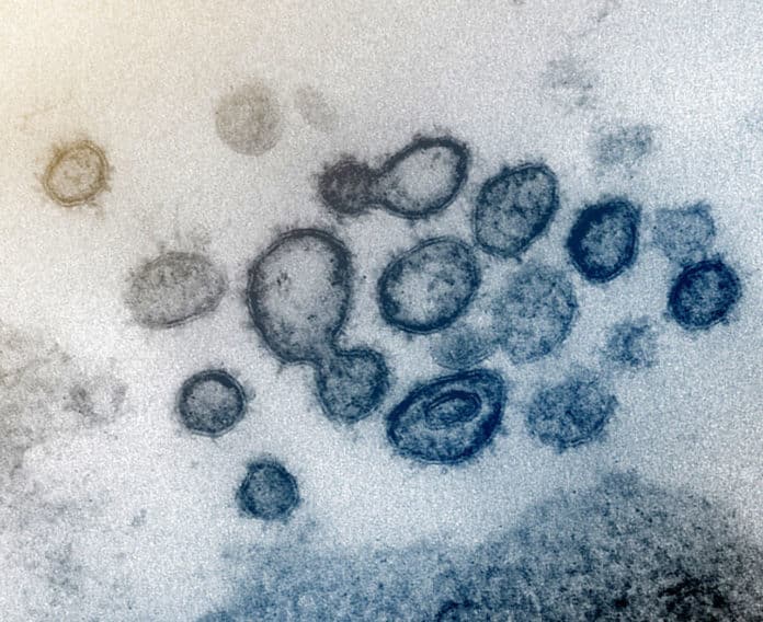 This transmission electron microscope image shows SARS-CoV-2 -- also known as 2019-nCoV, the virus that causes COVID-19 -- isolated from a patient in the US. Virus particles are shown emerging from the surface of cells cultured in the lab. The spikes on the outer edge of the virus particles give coronaviruses their name, crown-like. Credit: NIAID-RML