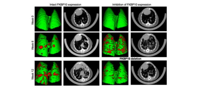 Three-dimensional lung (green) and tumors (red) and corresponding X-ray scans (black and white) at weeks 0, 6, and 12 after tumour onset (left: mouse with intact FKBP10; right: mouse with inhibition of FKBP10). At week 12, tumour growth is greatly reduced upon FKBP10 deletion. ©UNIGE Coppari/Collart labs