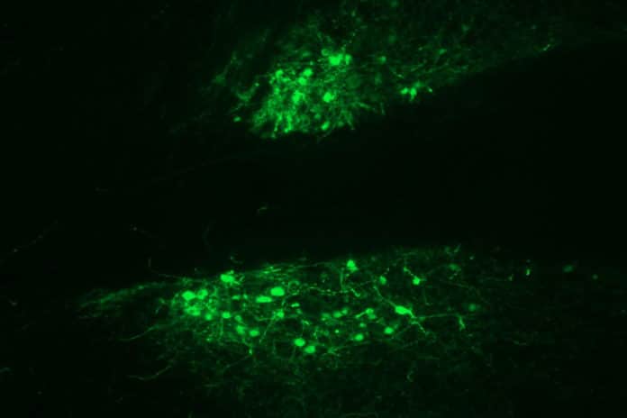 A magnified image of cells in the extended amygdala. The green color indicates cells that produce the kappa opioid receptor activating protein. Image courtesy of JR Haun.