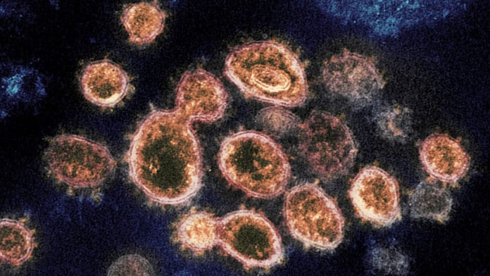 SARS-CoV-2, the virus that causes COVID-19.