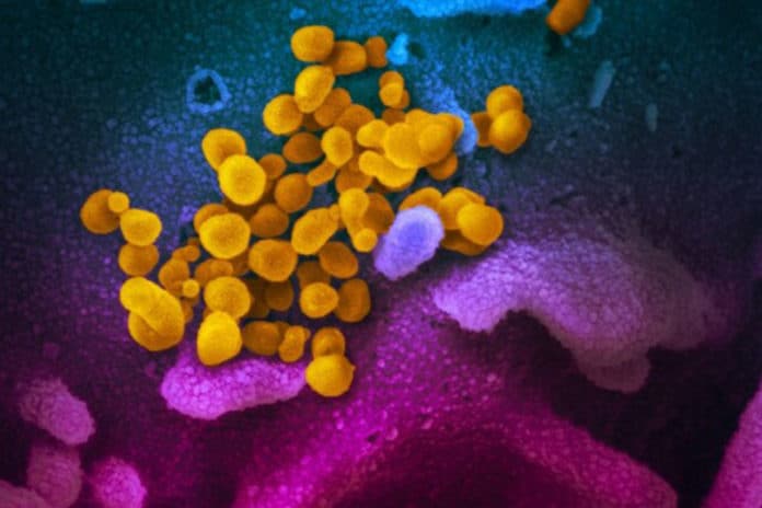 This scanning electron microscope image shows SARS-CoV-2 (yellow)—also known as 2019-nCoV, the virus that causes COVID-19—isolated from a patient, emerging from the surface of cells (blue/pink) cultured in the lab. Credit: NIAID-RML