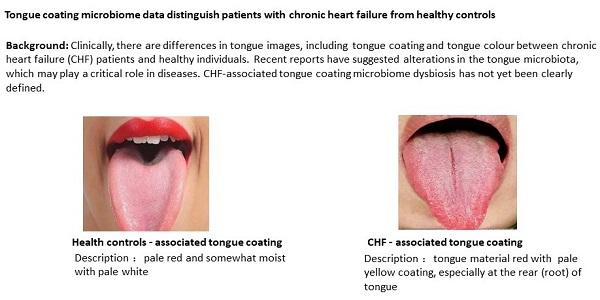 Clinically, there are differences in tongue images, including tongue coating and tongue colour between chronic heart failure (CHF) patients and healthy individuals. Recent reports have suggested alterations in the tongue microbiota, which may play a critical role in diseases. CHF-associated tongue coating microbiome dysbiosis has not yet been clearly defined.