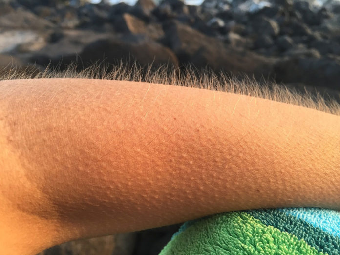 Scientists discovered the real reason behind goosebumps