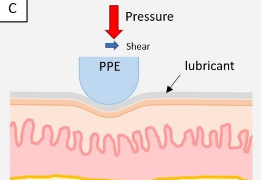 Friction-thwarting lubricants could save PPE wearers’ skin