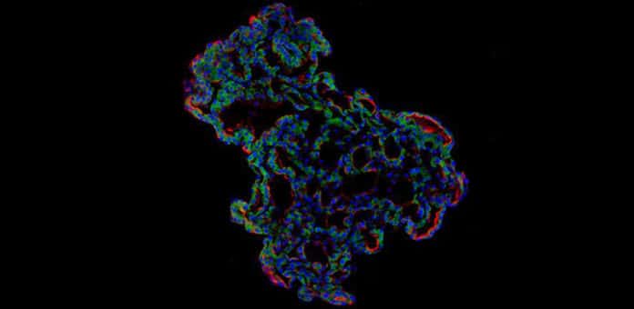 Representative image of three-dimensional human lung alveolar organoid
