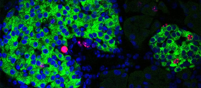 mage of pancreatic islets showing proliferation markers (in red staining) in the nuclei (in blue) of insulin-producing-cells (in green)