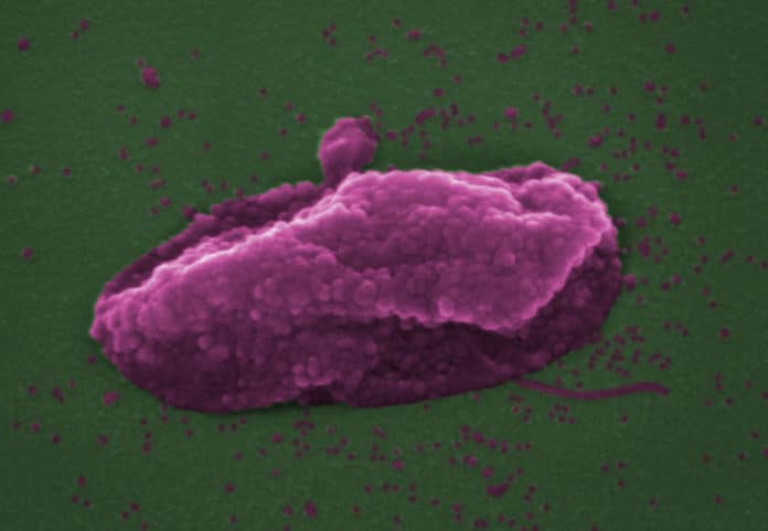 The superbug Pseudomonas aeruginosa after being ‘popped’ by the antibiotic colistin