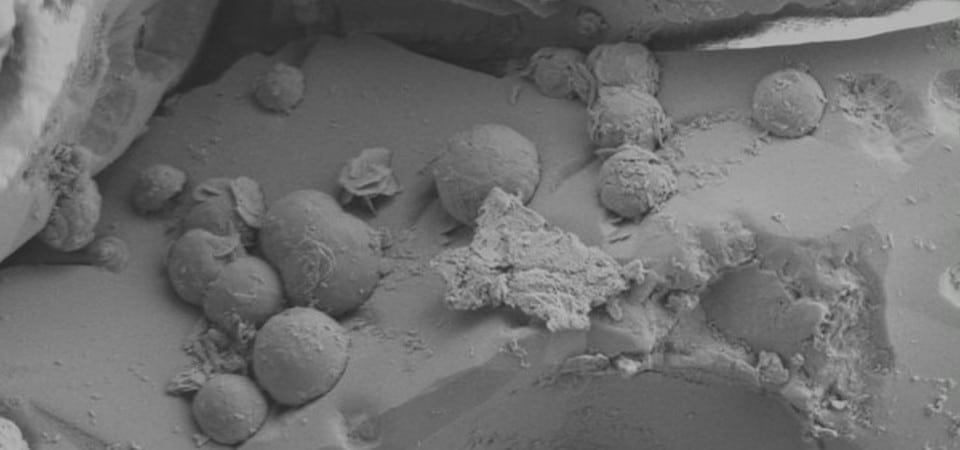 Imagen de electrones secundarios del cartílago mineral
