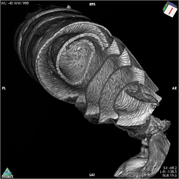 CT scan image of a dogfish shark spiral intestine