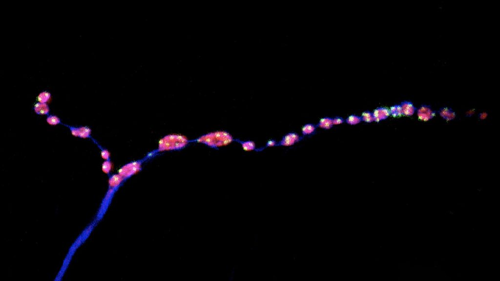 Adult Drosophila neuromuscular synaptic terminals
