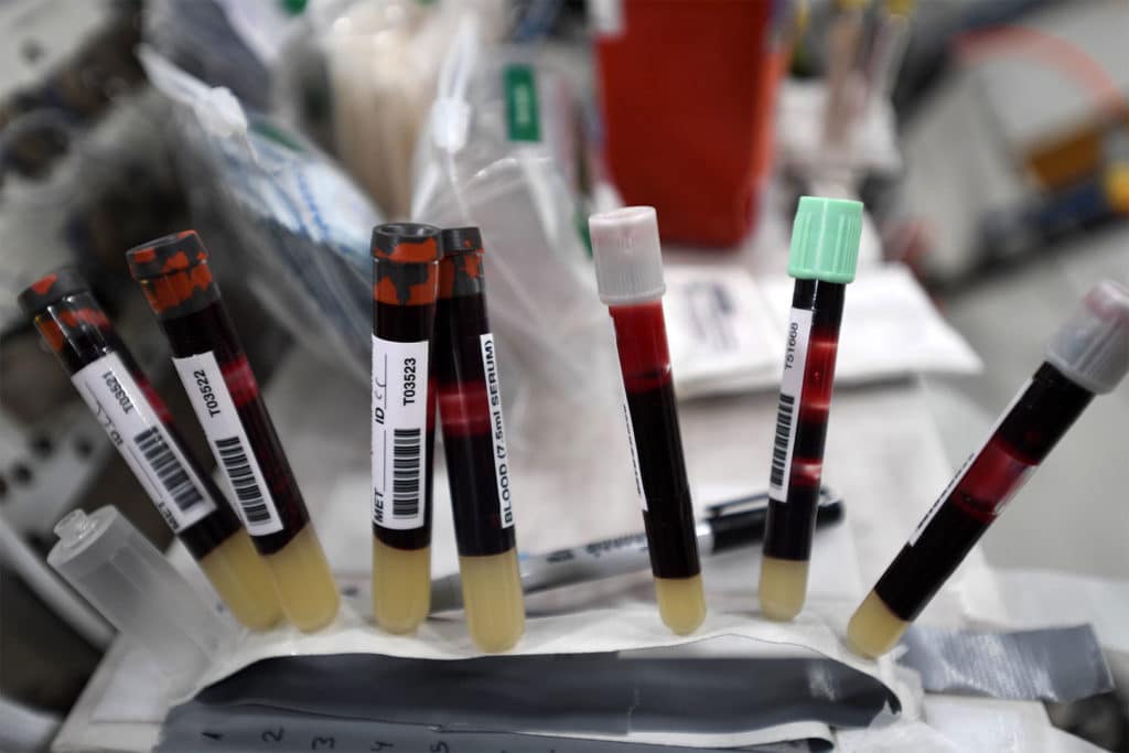 Blood samples taken by former NASA astronaut Chris Cassidy before aboard the International Space Station. Samples like these were taken before and after astronaut’s missions to space to measure radiation damage of astronauts in space.