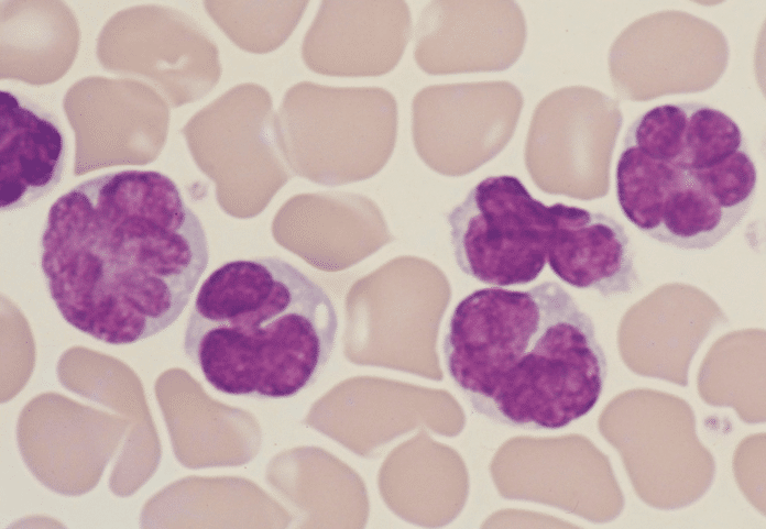 Virus-induced leukaemia cells
