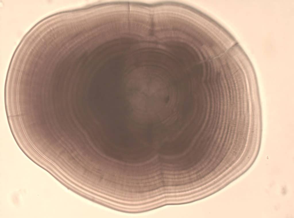 Example of otolith image under the microscope