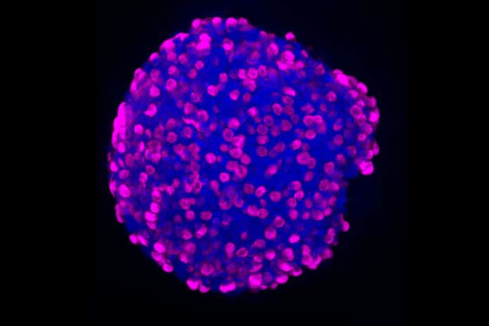 Using a newly developed protocol, Daniel Zeve, MD, and David Breault, MD, have been able to derive human enteroendocrine cells from human intestinal stem cells. They are shown here growing in a 3-D intestinal organoid.