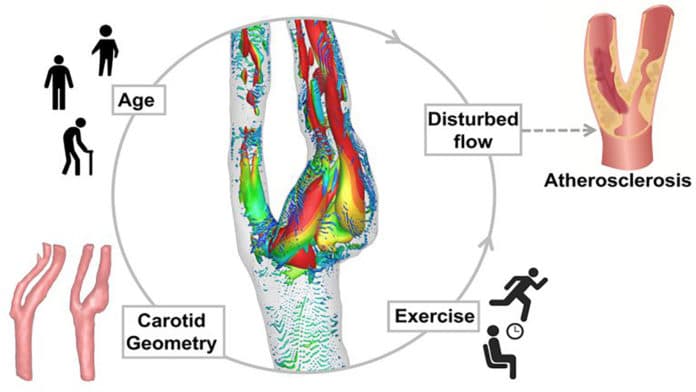 Exercise, age, and carotid geometry