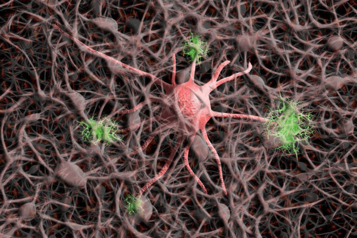 Image showing neuron