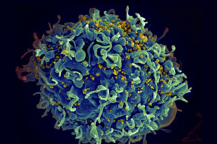 HIV viruses (yellow)