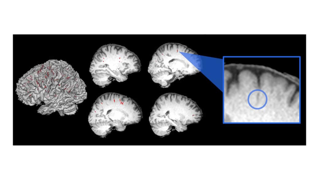 Astronaut brain images