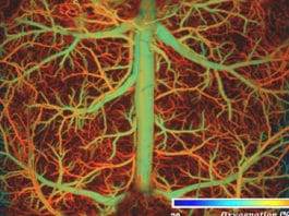 vasculature of the brain