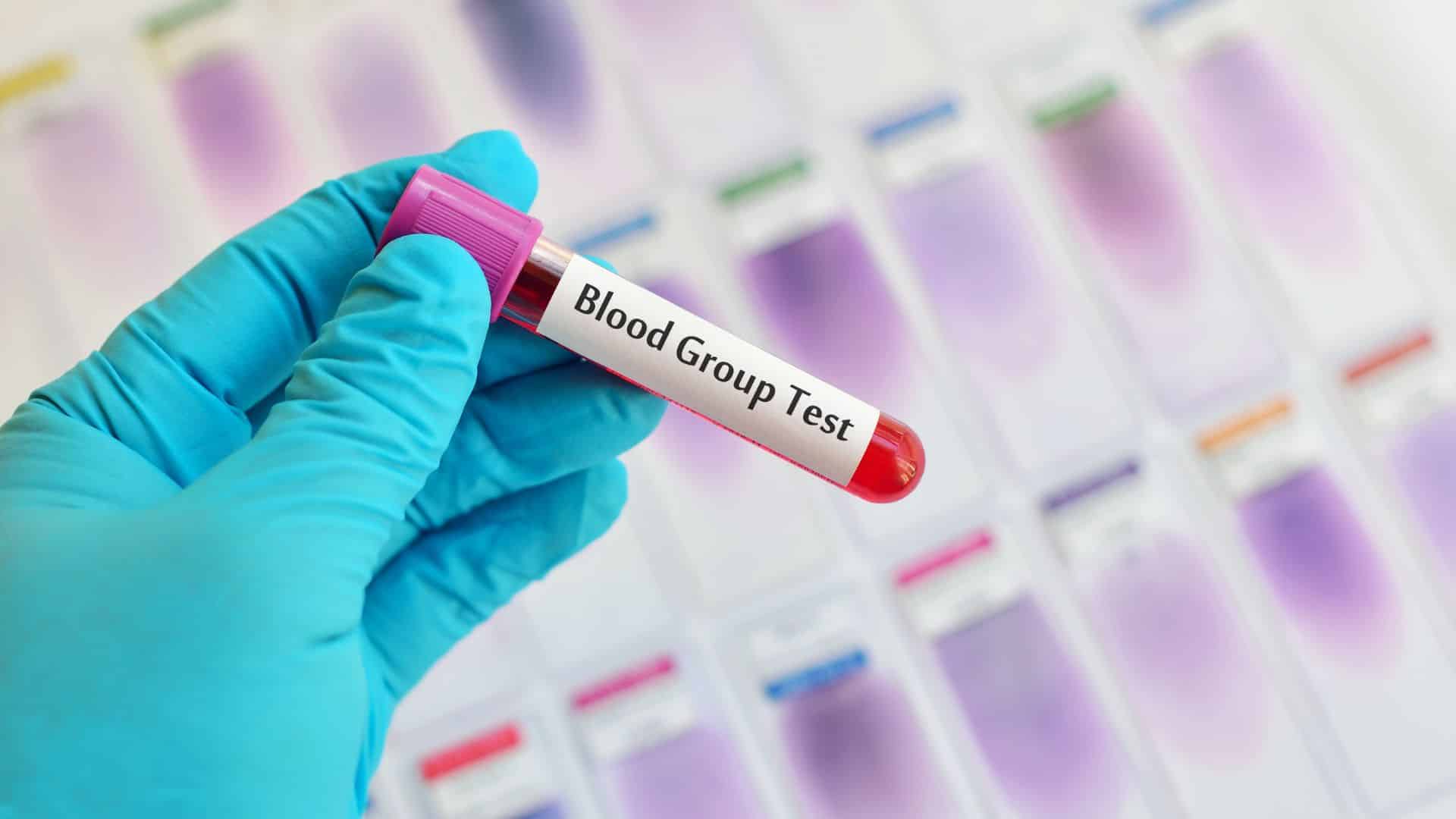 Image showing blood group test