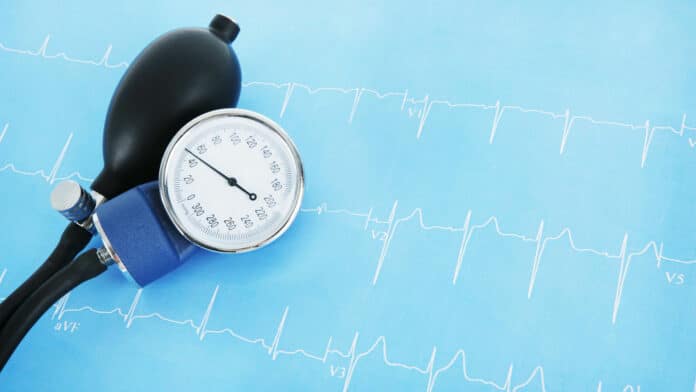Image showing blood pressure measuring equipment