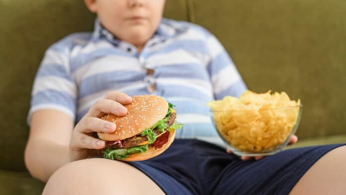 Image showing obese child