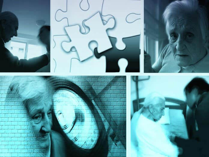 Image showing Alzheimer's patients