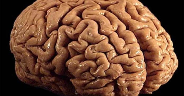 Wrinkled brain