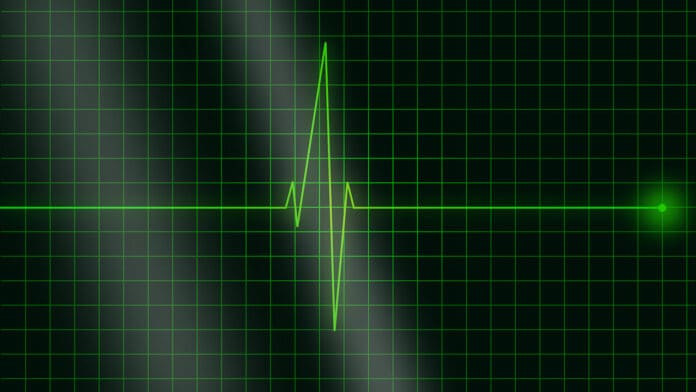 Image showing electrocardiogram