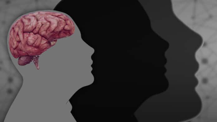 Image showing brain health